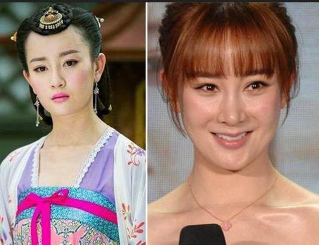坦然面對整容，女明星的美麗新篇章之旅