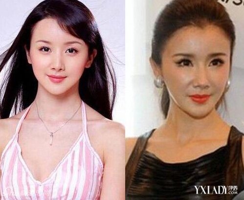 探秘明星整容的秘密，神秘美容小店的魅力所在！